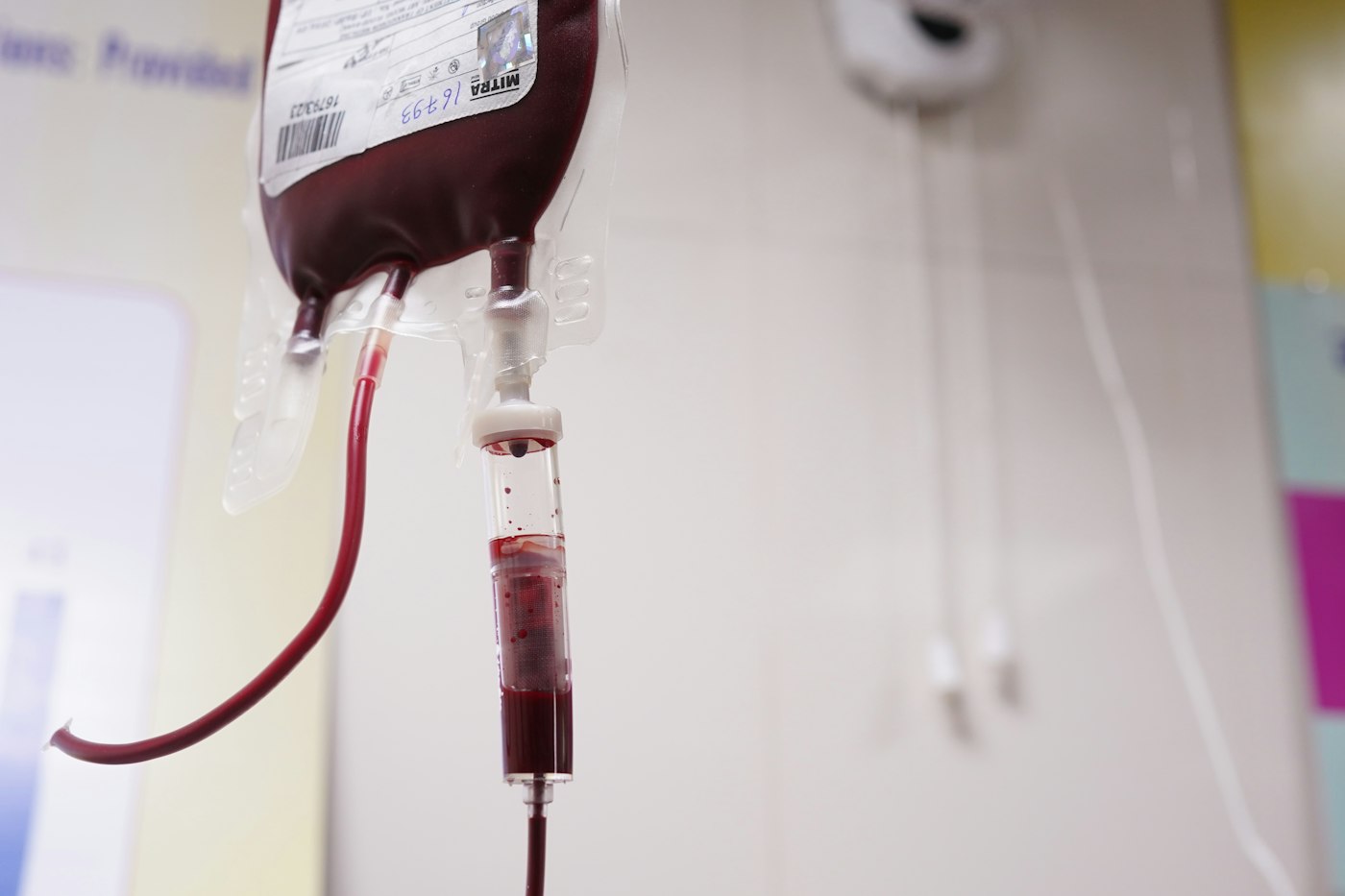Sacca di sangue appesa con il tubo di raccolta in un ambulatorio